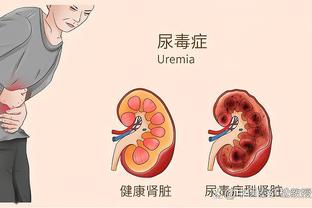 明日战老鹰 利拉德因个人原因缺席 字母哥与米德尔顿大概率出战